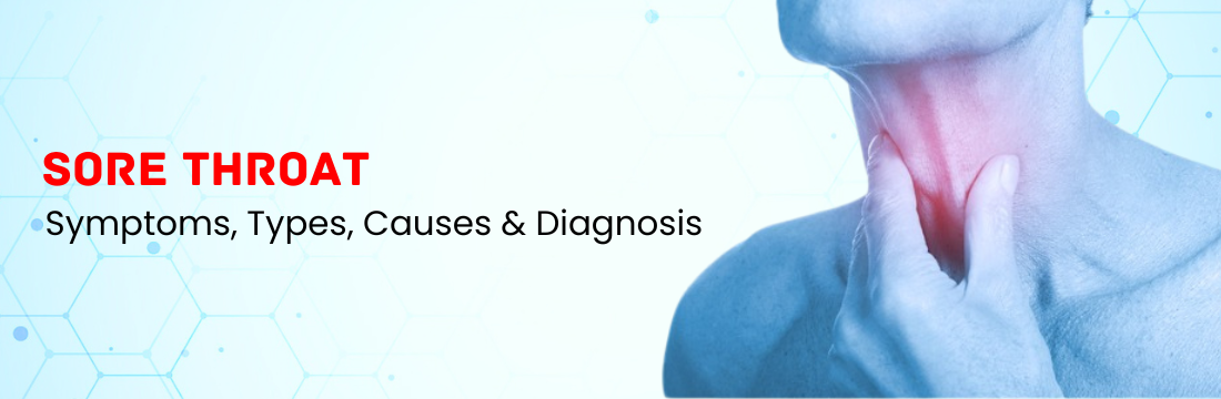 Sore Throat: Symptoms, Types, Causes & Diagnosis